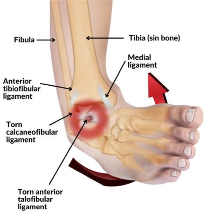 
Josh Hart Injury 2022: Updates About Left Ankle Sprain- Where Is He Today? 